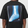 K1X Ankle Breaker Tee Black XL